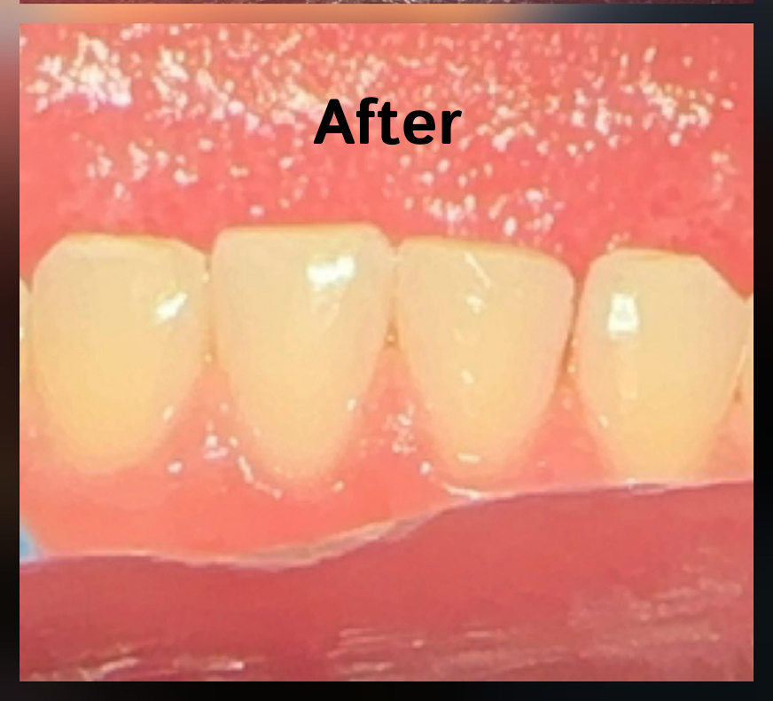 After