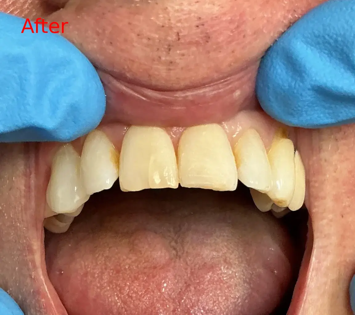 after-image