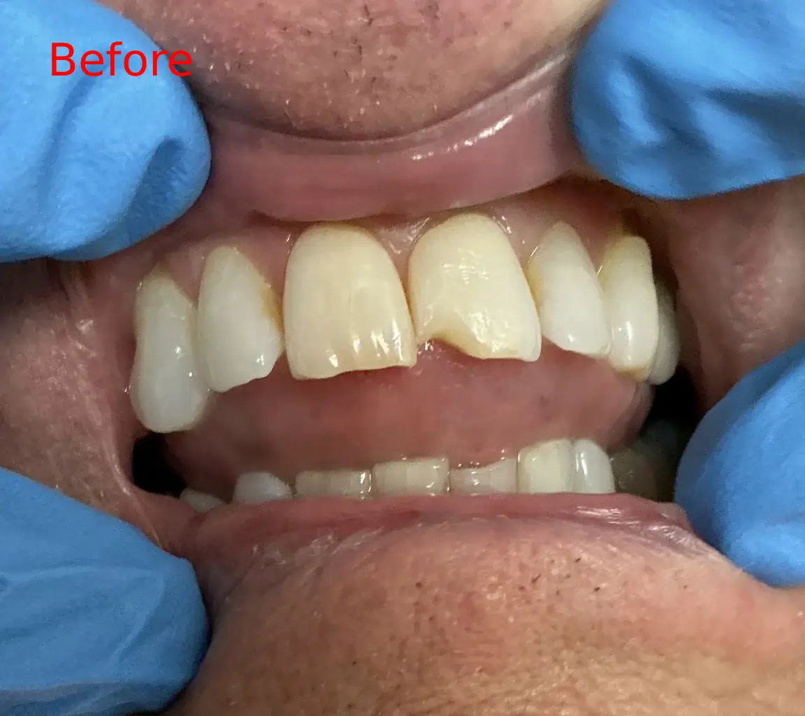 before-image