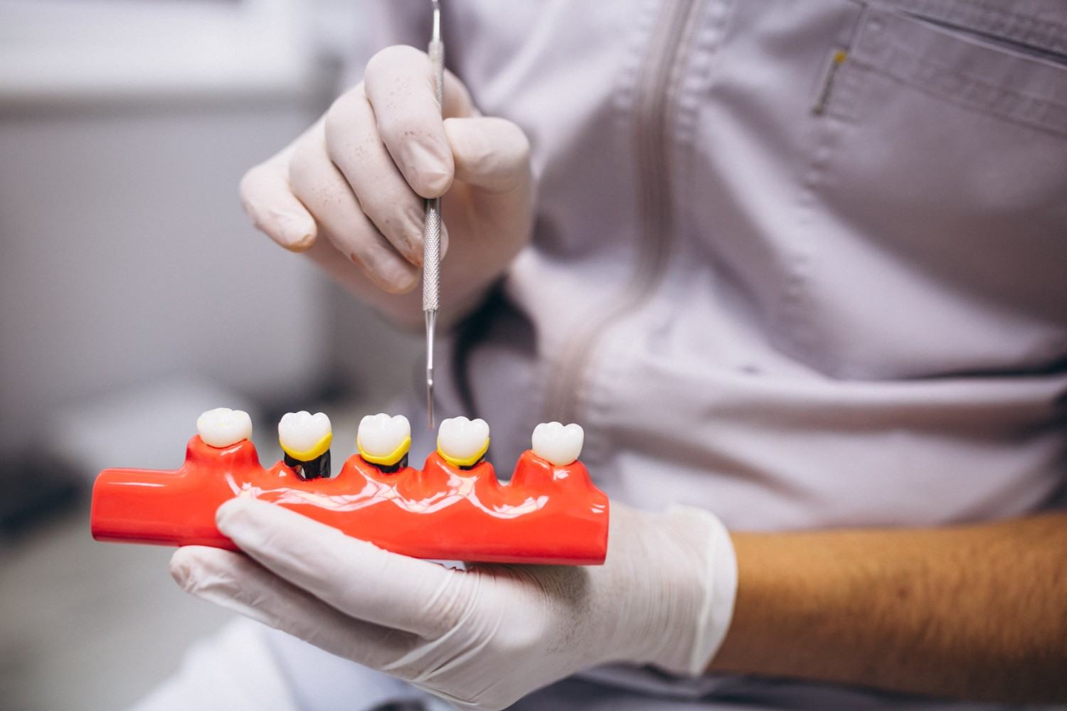 can a dental crown save a cracked tooth